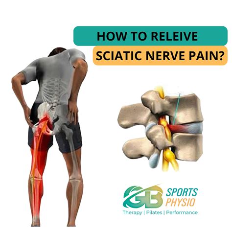 what does sciatic nerve feel like